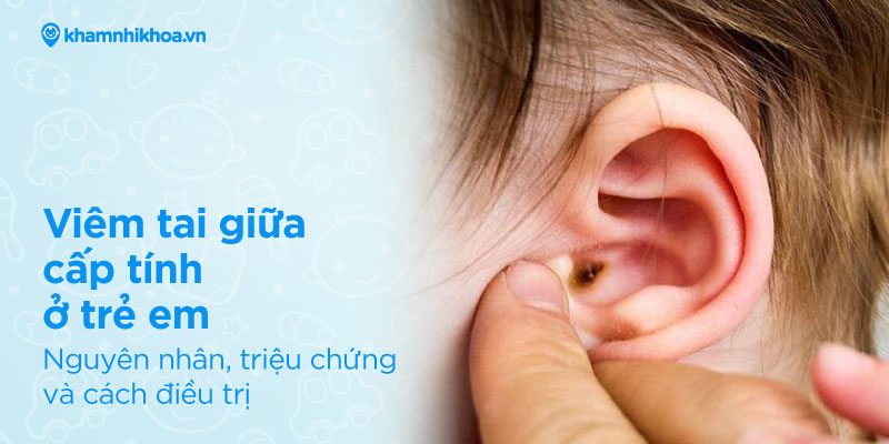 Viêm tai giữa cấp tính ở trẻ em – 3 biến chứng nguy hiểm cần lưu ý